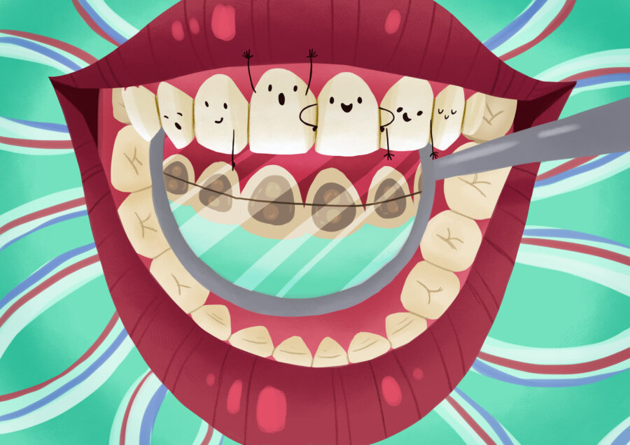 lingual braces, an adult orthodontic option at Cin dental